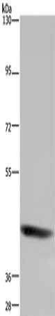 FOXD4 Antibody (PACO17891)