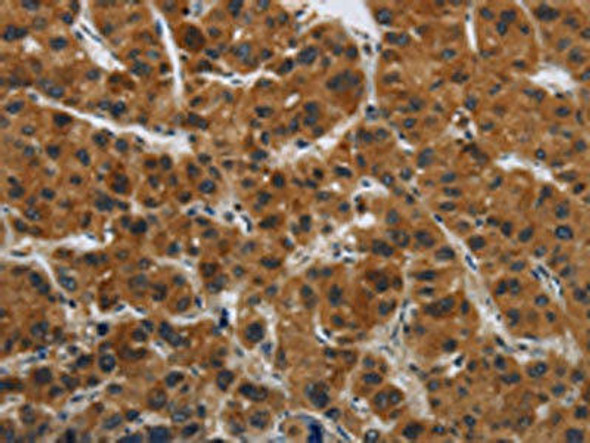 GATA5 Antibody (PACO17936)