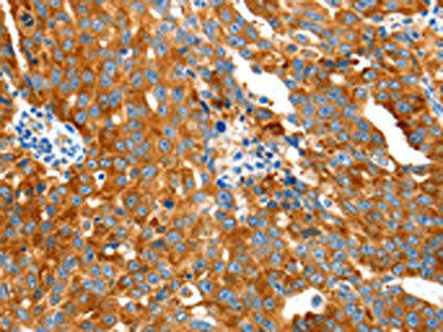 GDF6 Antibody (PACO17980)