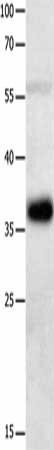 MAGEA2 Antibody (PACO18185)