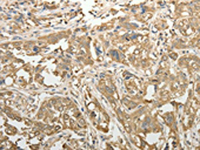 ADHFE1 Antibody (PACO18520)