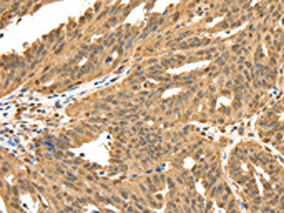 SPATA20 Antibody (PACO18920)