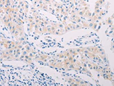 ADAMTS17 Antibody (PACO19062)
