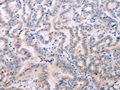 ADCY5 Antibody (PACO19065)