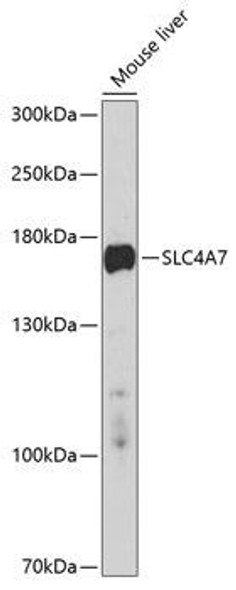 Anti-SLC4A7 Antibody (CAB10271)