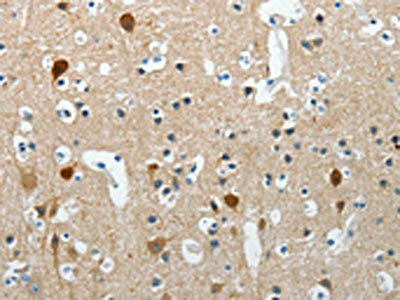 RCAN2 Antibody (PACO19177)