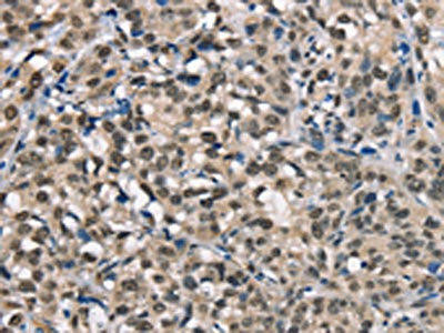 NDNL2 Antibody (PACO19227)