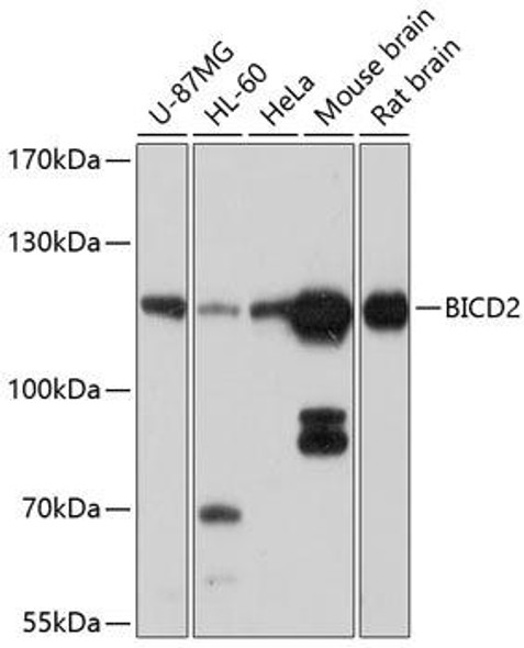Anti-BICD2 Antibody (CAB10292)