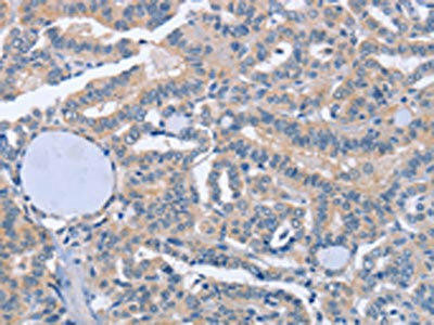 BOD1 Antibody (PACO19359)