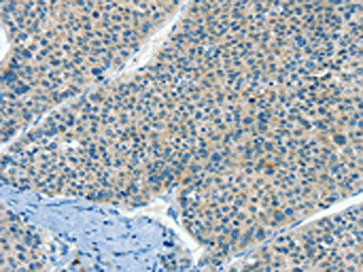 HID1 Antibody (PACO19503)