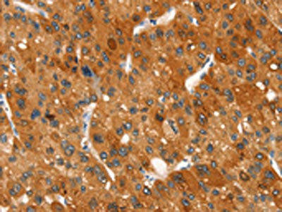 CLEC6A Antibody (PACO19556)
