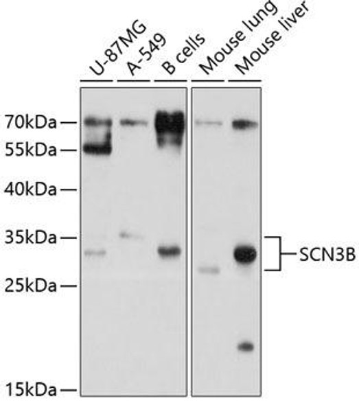 Anti-SCN3B Antibody (CAB10316)