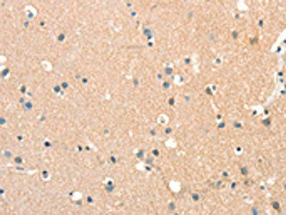 STK17A Antibody (PACO19582)