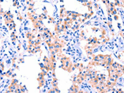ERN2 Antibody (PACO19617)