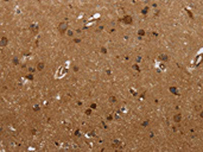 FMN2 Antibody (PACO19671)