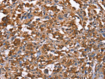 HRASLS2 Antibody (PACO19782)