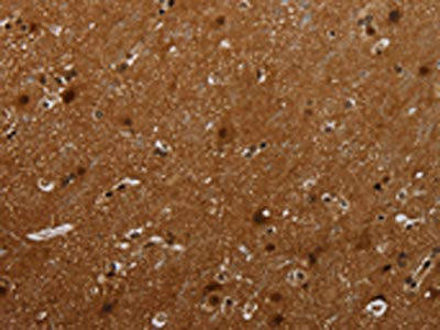 MAGEB18 Antibody (PACO19974)