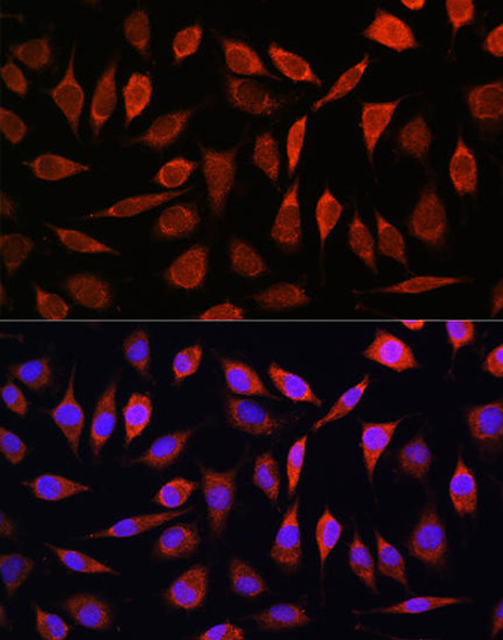 Anti-ZIP8 Antibody (CAB10395)