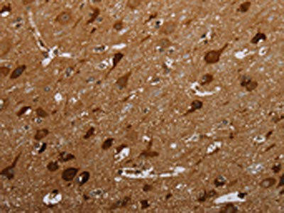MAGEC2 Antibody (PACO19979)