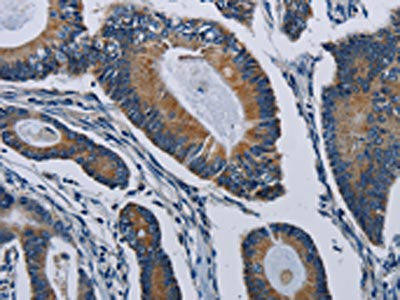 PCDHAC2 Antibody (PACO20186)