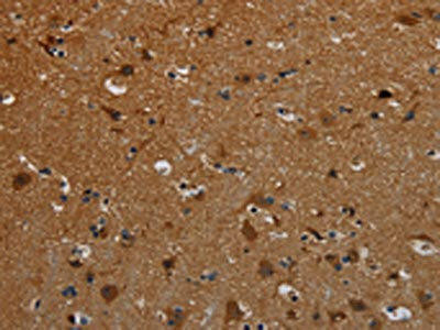 PCDHB15 Antibody (PACO20192)