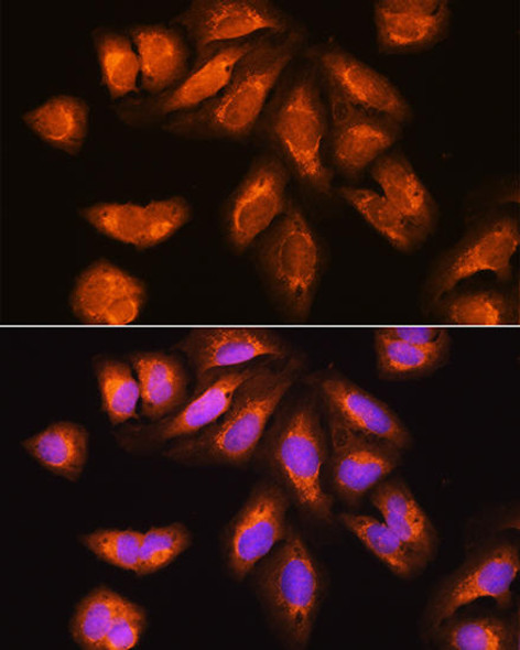 Anti-EXOSC2 Antibody (CAB10450)