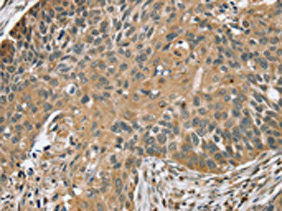 TRIM3 Antibody (PACO20357)