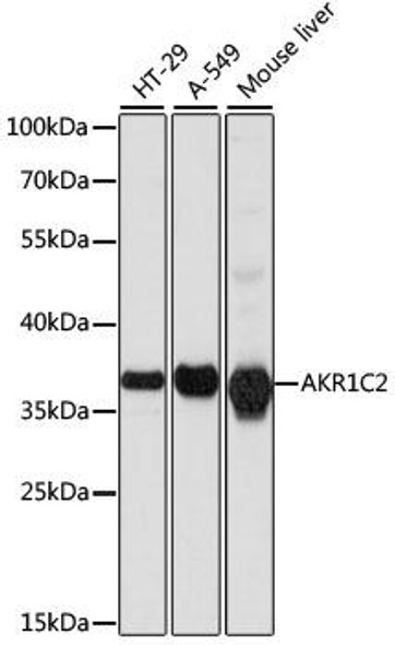 Anti-AKR1C2 Antibody (CAB1048)