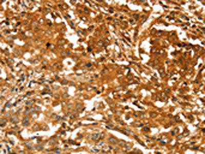 SLC41A2 Antibody (PACO20509)