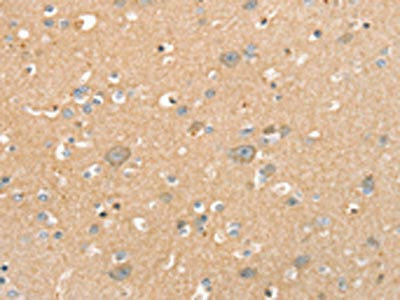 SLC41A2 Antibody (PACO20511)