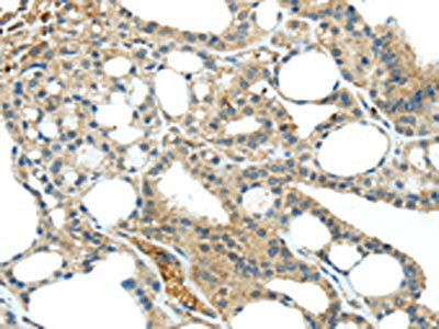 TNIP1 Antibody (PACO20729)