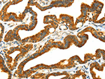 PRSS50 Antibody (PACO20775)