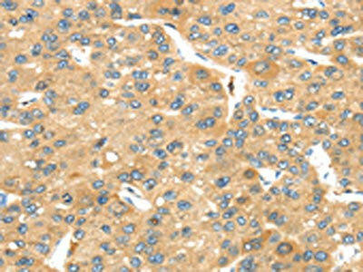 UBTD2 Antibody (PACO20811)