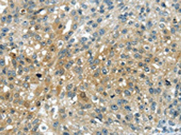 UPP2 Antibody (PACO20838)