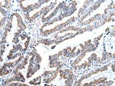 XKR4 Antibody (PACO20940)