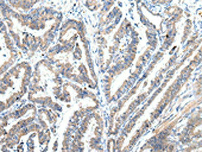 ZFAND2A Antibody (PACO20945)