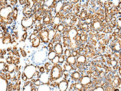 KRT7 Antibody (PACO20973)