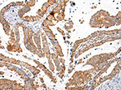 KRT20 Antibody (PACO20974)