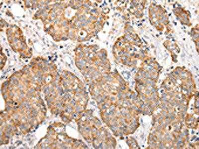 COL8A2 Antibody (PACO20976)