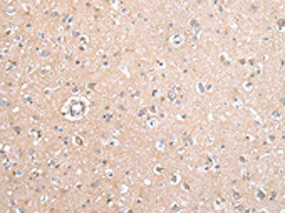 GJB5 Antibody (PACO21019)