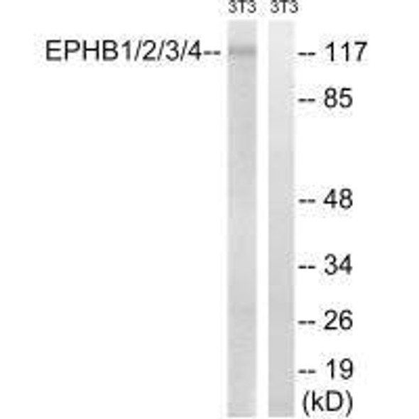 EPHB1/EPHB2/EPHB3/EPHB4 (Ab-600/602/614/596) Antibody (PACO21598)
