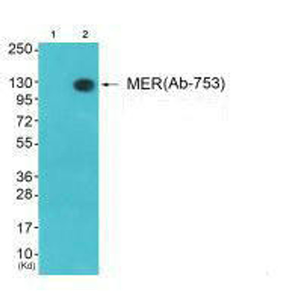 MERTK/TYRO3 (Ab-753) Antibody (PACO21647)