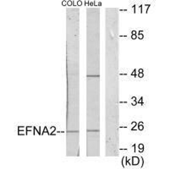EFNA2 Antibody (PACO21689)