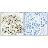 MAP3K6 Antibody (PACO21709)