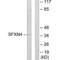 SFXN4 Antibody (PACO21880)