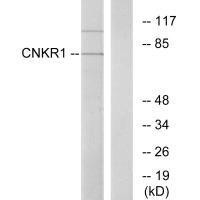 CNKSR1 Antibody (PACO21922)