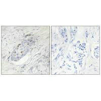 ZNF232 Antibody (PACO21986)