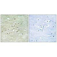 NPAS4 Antibody (PACO22467)