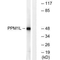 PPM1L Antibody (PACO22527)