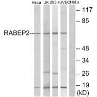 RABEP2 Antibody (PACO22536)